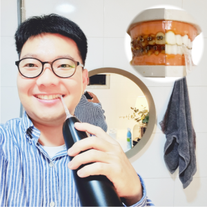 텐시클 치아 교정 교정용 구강 세정기
