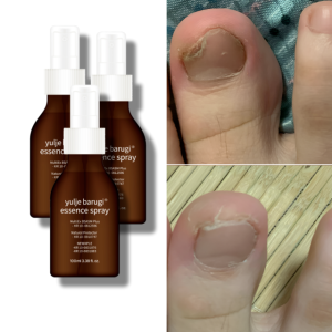 율제 손 발톱 무좀 약 에센스 크림 스프레이