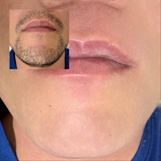 브라질리언왁싱 오유비뷰티