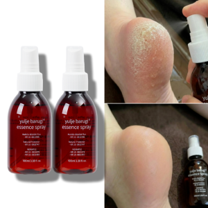 율제 풋 무좀 발냄새 제거 스프레이 2개