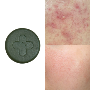 메디좀 클렌징 바 천연 어성초 여드름 모낭염 피지 모공각화증 수제 세수비누